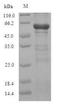 Recombinant Human Oxysterols receptor LXR-alpha (NR1H3) – Figure 1 of 1