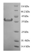 Recombinant Human Mitotic spindle assembly checkpoint protein MAD2A (MAD2L1) – Figure 1 of 1
