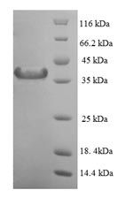 Recombinant Human Mitotic spindle assembly checkpoint protein MAD2A (MAD2L1) – Figure 1 of 1