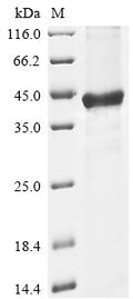 Recombinant Human GDP-L-fucose synthase (GFUS) – Figure 1 of 1