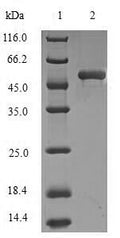 (Tris-Glycine gel) Discontinuous SDS-PAGE (reduced) with 5% enrichment gel and 15% separation gel.