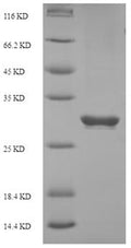 Recombinant Human Programmed cell death protein 1 (PDCD1), partial – Figure 1 of 1