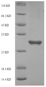 Recombinant Human Programmed cell death protein 1 (PDCD1), partial – Figure 1 of 1