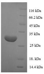 Recombinant Human POU domain class 2-associating factor 1 (POU2AF1) – Figure 1 of 1