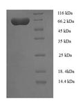 Recombinant Human UTP--glucose-1-phosphate uridylyltransferase (UGP2) – Figure 1 of 1