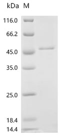 (Tris-Glycine gel) Discontinuous SDS-PAGE (reduced) with 5% enrichment gel and 15% separation gel.