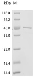 (Tris-Glycine gel) Discontinuous SDS-PAGE (reduced) with 5% enrichment gel and 15% separation gel.