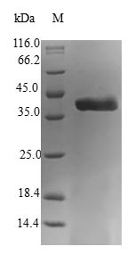 (Tris-Glycine gel) Discontinuous SDS-PAGE (reduced) with 5% enrichment gel and 15% separation gel.