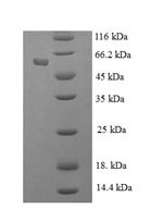 Recombinant Human Histone-binding protein RBBP7 (RBBP7) – Figure 1 of 1