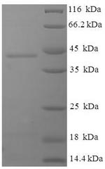 Recombinant Human Deoxyguanosine kinase, mitochondrial (DGUOK) – Figure 1 of 1