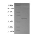 Recombinant Human Coactosin-like protein (COTL1) – Figure 1 of 1