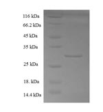 Recombinant Human Coactosin-like protein (COTL1) – Figure 1 of 1