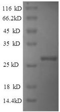 Recombinant Human Indian hedgehog protein (IHH), partial – Figure 1 of 1