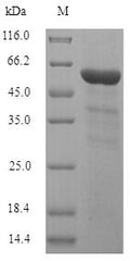 Recombinant Human Inositol polyphosphate-5-phosphatase A (INPP5A) – Figure 1 of 1