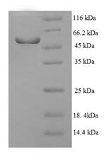 Recombinant Human Nuclear receptor subfamily 1 group I member 3 (NR1I3), partial – Figure 1 of 1