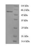 Recombinant Human Angiopoietin-1 (ANGPT1) – Figure 1 of 1