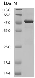 (Tris-Glycine gel) Discontinuous SDS-PAGE (reduced) with 5% enrichment gel and 15% separation gel.