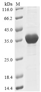 (Tris-Glycine gel) Discontinuous SDS-PAGE (reduced) with 5% enrichment gel and 15% separation gel.