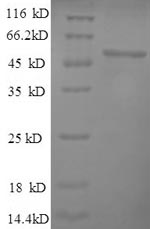 Recombinant Human Hyaluronidase-1 (HYAL1) – Figure 1 of 1