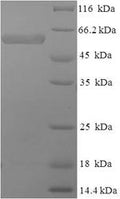 Recombinant Human SWI/SNF-related matrix-associated actin-dependent regulator of chromatin subfamily B member 1 (SMARCB1), pa