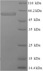 Recombinant Human SWI/SNF-related matrix-associated actin-dependent regulator of chromatin subfamily B member 1 (SMARCB1), pa