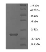 Recombinant Human Secretory phospholipase A2 receptor (PLA2R1), partial – Figure 1 of 1