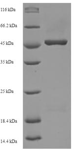 (Tris-Glycine gel) Discontinuous SDS-PAGE (reduced) with 5% enrichment gel and 15% separation gel.