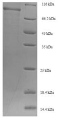 Recombinant Human Sorting nexin-1 (SNX1) – Figure 1 of 1