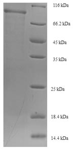 Recombinant Human Sorting nexin-1 (SNX1) – Figure 1 of 1