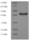 Recombinant Human Core-binding factor subunit beta (CBFB) – Figure 1 of 1