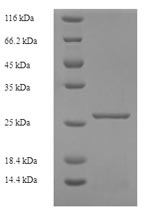 Recombinant Human Killer cell immunoglobulin-like receptor 2DS1 (KIR2DS1), partial – Figure 1 of 1