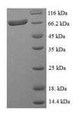 Recombinant Human Rho GTPase-activating protein 19 (ARHGAP19) – Figure 1 of 1