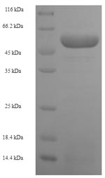 Recombinant Human Squamous cell carcinoma antigen recognized by T-cells 3 (SART3), partial – Figure 1 of 1