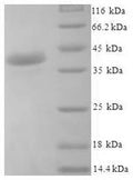 Recombinant Human Josephin-1 (JOSD1) – Figure 1 of 1