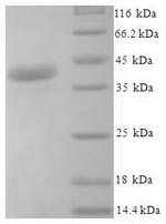 Recombinant Human Josephin-1 (JOSD1) – Figure 1 of 1