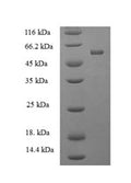 Recombinant Human protein-tyrosine-phosphatase (PTPRR) – Figure 1 of 1