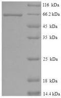 Recombinant Human Serine/threonine-protein kinase STK11 (STK11) – Figure 1 of 1