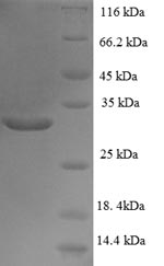 Recombinant Human Transcription initiation factor TFIID subunit 12 (TAF12) – Figure 1 of 1