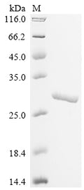 (Tris-Glycine gel) Discontinuous SDS-PAGE (reduced) with 5% enrichment gel and 15% separation gel.