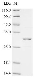 (Tris-Glycine gel) Discontinuous SDS-PAGE (reduced) with 5% enrichment gel and 15% separation gel.