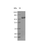 (Tris-Glycine gel) Discontinuous SDS-PAGE (reduced) with 5% enrichment gel and 15% separation gel.