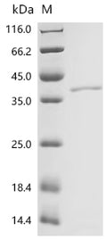 (Tris-Glycine gel) Discontinuous SDS-PAGE (reduced) with 5% enrichment gel and 15% separation gel.