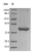 Recombinant Human Embryonic stem cell-related gene protein (HESRG) – Figure 1 of 1