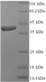 Recombinant Human Izumo sperm-egg fusion protein 4 (IZUMO4) – Figure 1 of 1