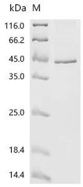(Tris-Glycine gel) Discontinuous SDS-PAGE (reduced) with 5% enrichment gel and 15% separation gel.