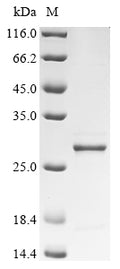 (Tris-Glycine gel) Discontinuous SDS-PAGE (reduced) with 5% enrichment gel and 15% separation gel.