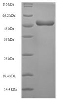Recombinant Lake Victoria marburgvirus Matrix protein VP40 (VP40) – Figure 1 of 1