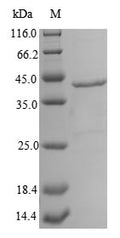 (Tris-Glycine gel) Discontinuous SDS-PAGE (reduced) with 5% enrichment gel and 15% separation gel.
