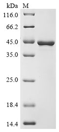 (Tris-Glycine gel) Discontinuous SDS-PAGE (reduced) with 5% enrichment gel and 15% separation gel.