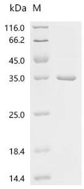 (Tris-Glycine gel) Discontinuous SDS-PAGE (reduced) with 5% enrichment gel and 15% separation gel.